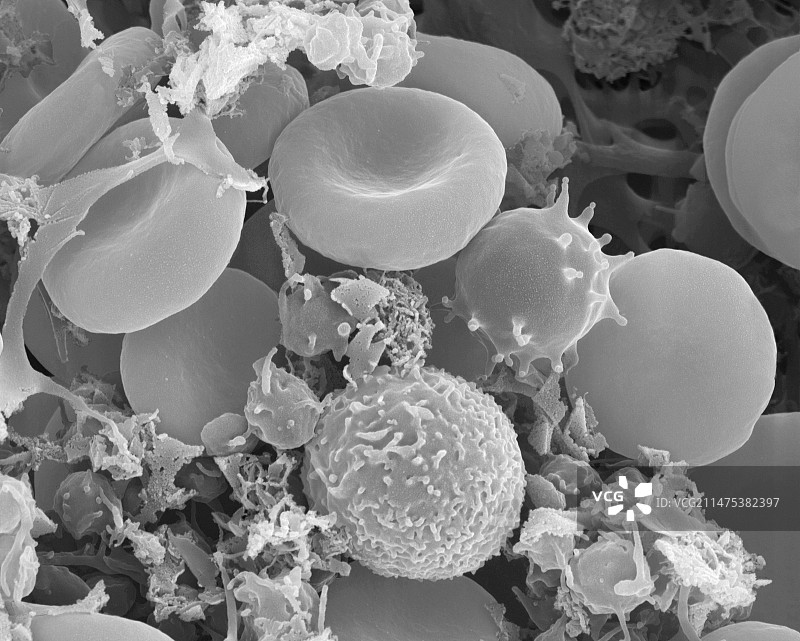 人类红细胞和白细胞，扫描电子显微镜图片素材