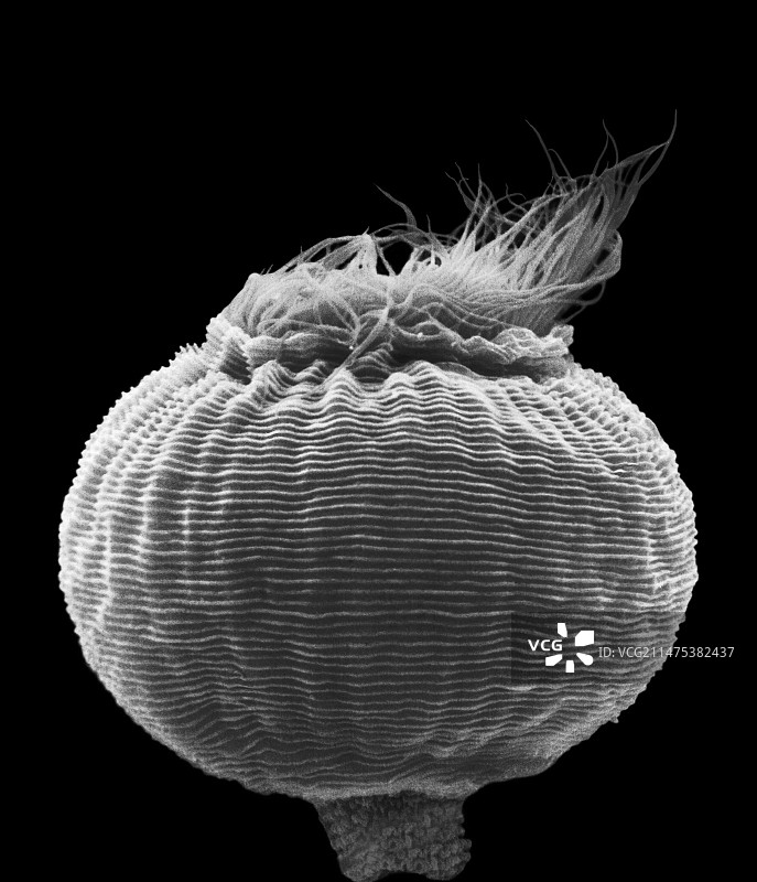 原生动物（钟虫属），扫描电子显微镜图片素材