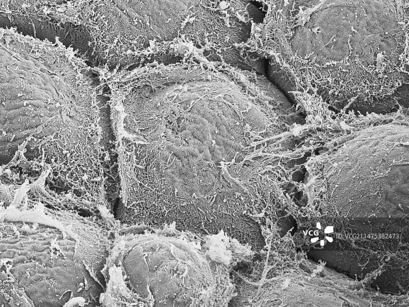 夏威夷珊瑚状红藻，SEM图片素材