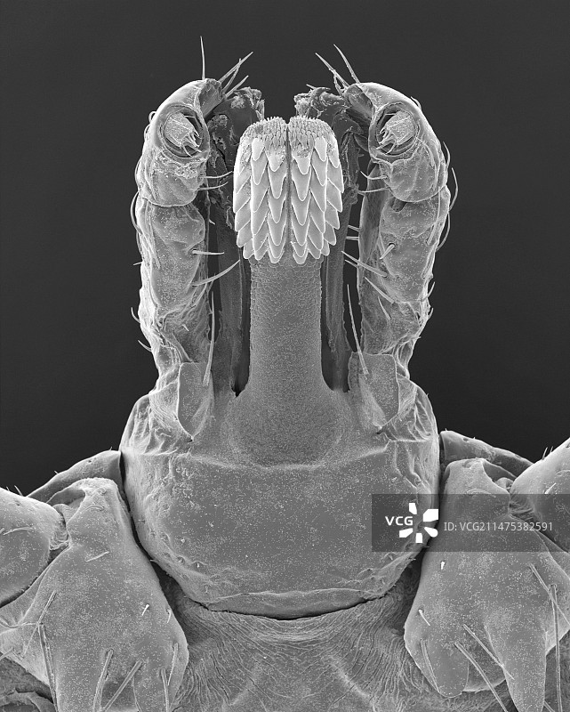 美洲钝眼蜱头部扫描电镜照片图片素材
