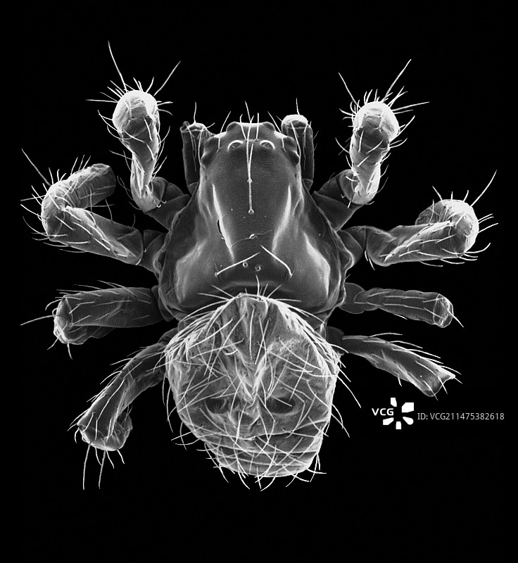 吊床蜘蛛(Pityohyphantes costatus),扫描电子显微镜图片素材