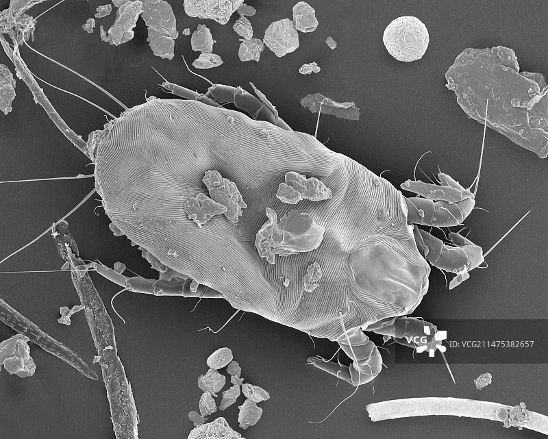 尘螨，扫描电子显微镜图片素材
