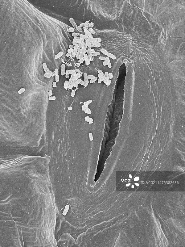 感染大肠杆菌的菠菜，扫描电子显微镜图像图片素材