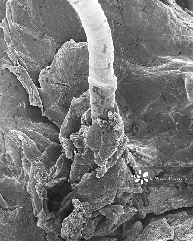 人皮肤和毛囊上的大肠杆菌扫描电镜图图片素材
