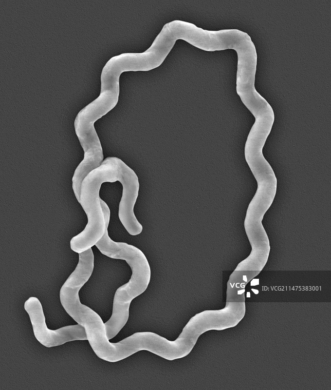 黑海厌氧细菌扫描电镜图图片素材