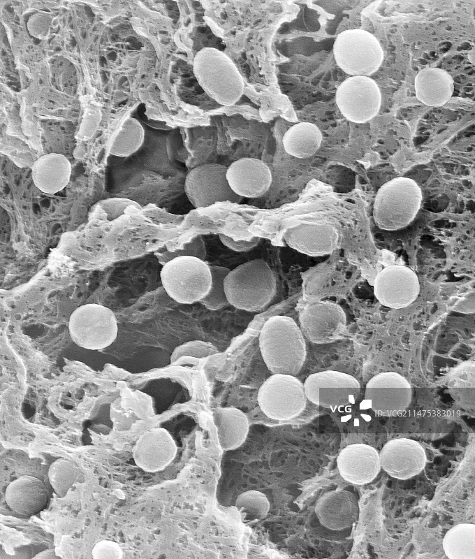 Acidobacterium sp.土壤原核生物，扫描电子显微镜图片素材