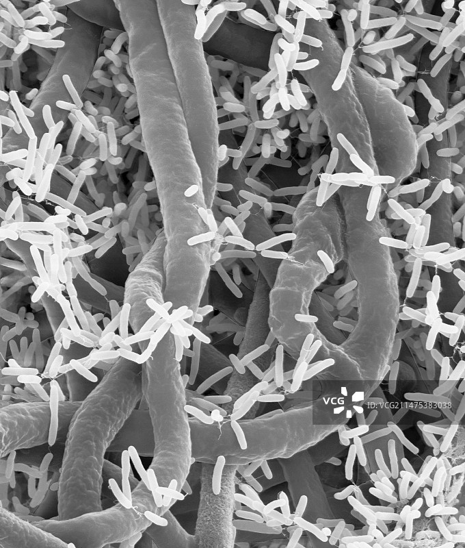 假单胞菌和腐霉菌，扫描电镜图片素材
