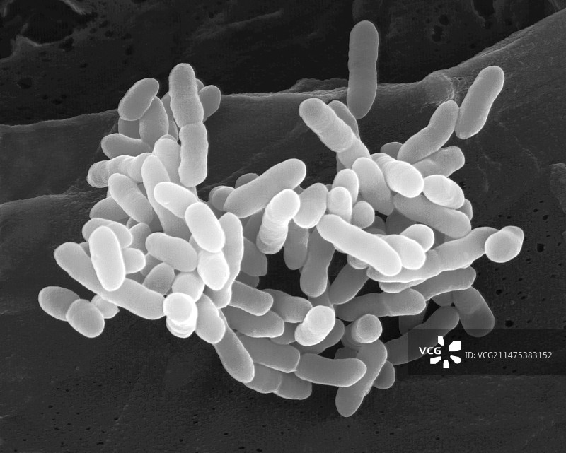 奇异变形杆菌扫描电镜图像图片素材