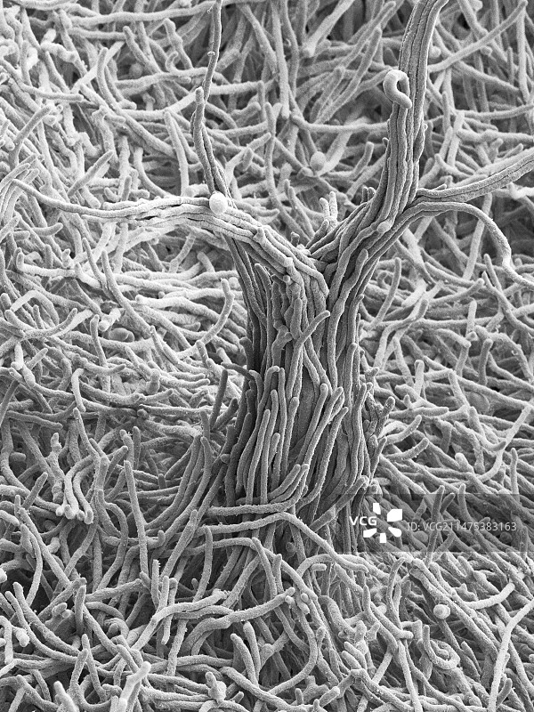 旋刺外瓶霉菌土壤真菌扫描电镜图图片素材