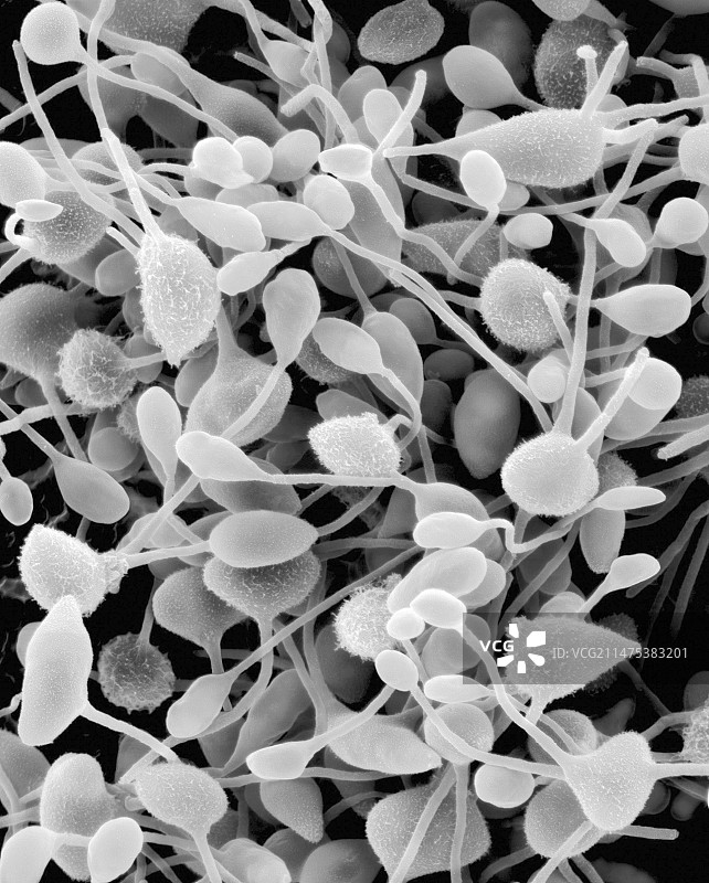 担子菌酵母Fellomyces sp.，扫描电镜图片素材