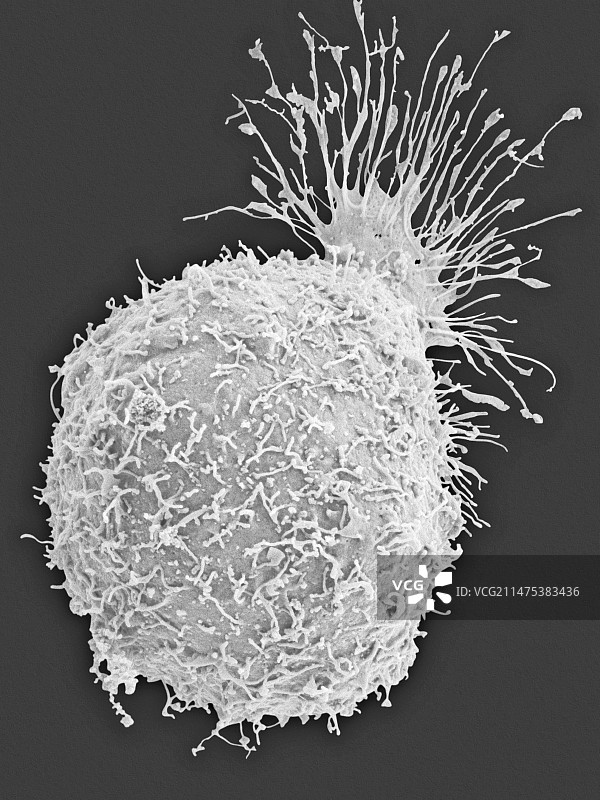 昆虫卵巢细胞，扫描电镜图片素材