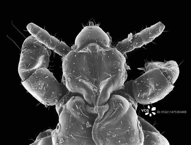 头虱，扫描电子显微镜图片素材
