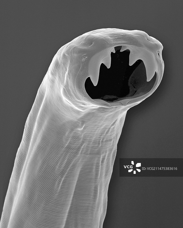 猫钩虫（巴西钩口线虫），扫描电子显微镜图片素材