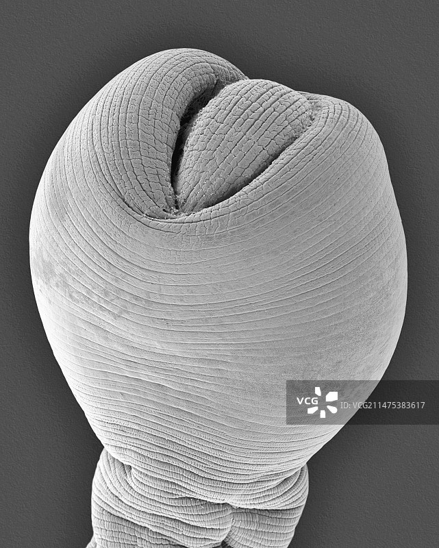 犬绦虫囊尾蚴期，扫描电镜图片素材