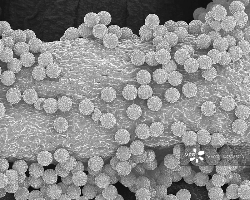 西番莲花药上的西番莲花粉(Passiflora coccinea),SEM图片素材