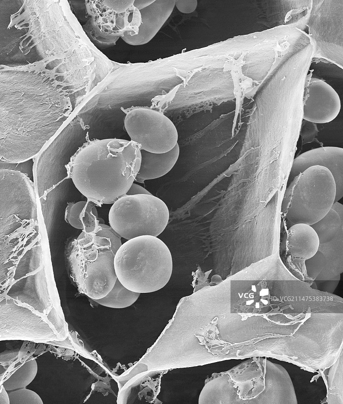 马铃薯淀粉颗粒（扫描电镜图）图片素材