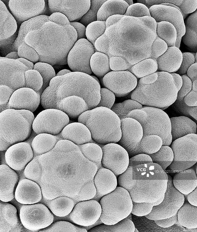 花椰菜头部中的花蕾，扫描电镜图片素材
