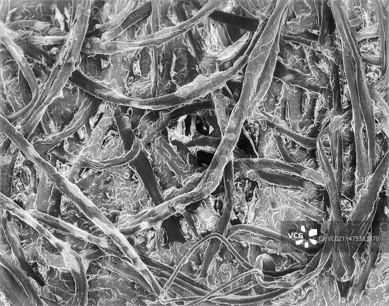 扫描电镜下的棉签耳垢图片素材