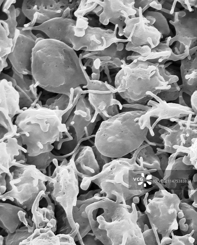 活化血小板（扫描电镜图）图片素材