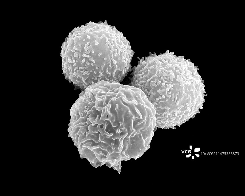 T淋巴细胞和中性粒细胞扫描电镜图图片素材