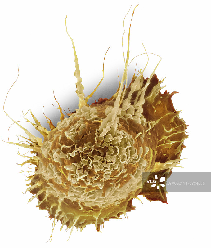 肺泡巨噬细胞，SEM图片素材