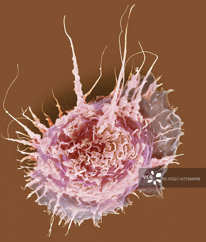 肺泡巨噬细胞，SEM图片素材