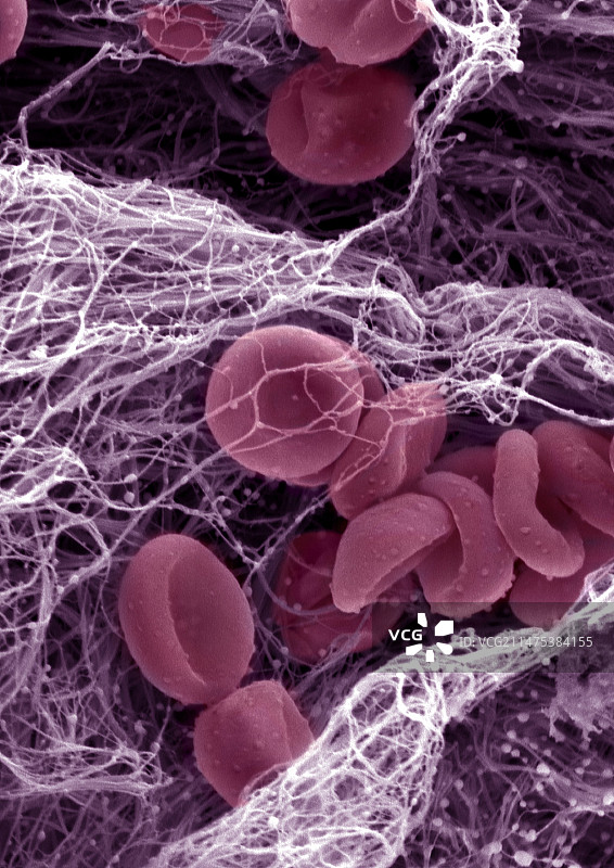 血栓扫描电镜图片素材