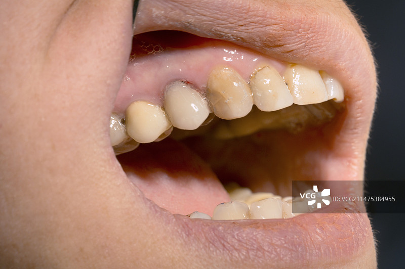 化妆品修复图片素材