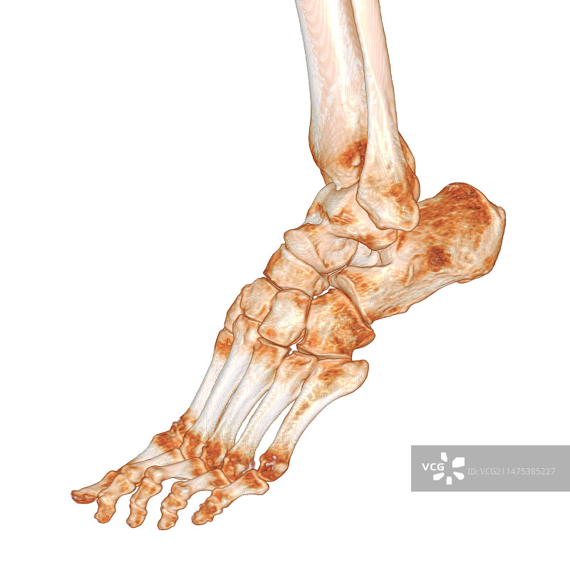 人类足部3D CT扫描图片素材
