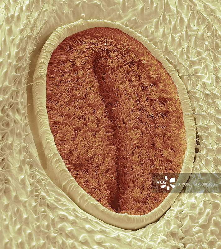 毛毛虫气门扫描电镜图图片素材