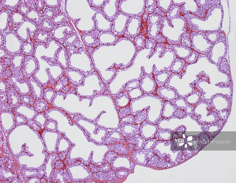 泪腺显微照片图片素材