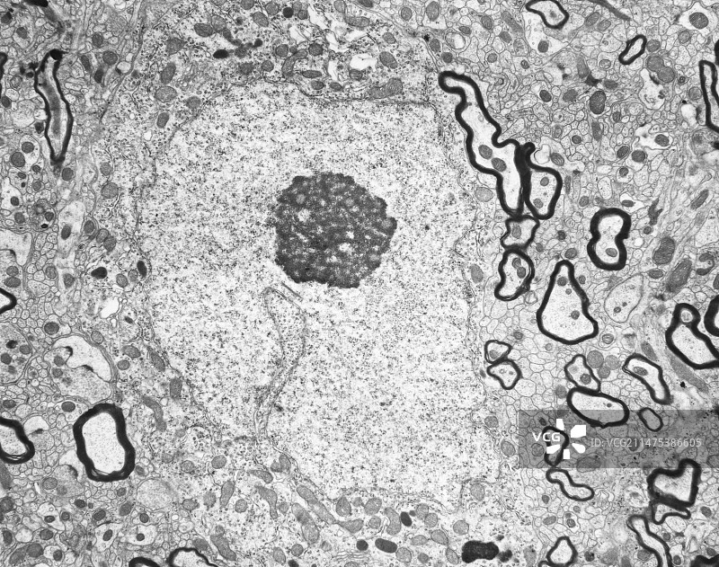 具有大细胞核和核仁的神经元（透射电子显微镜）图片素材
