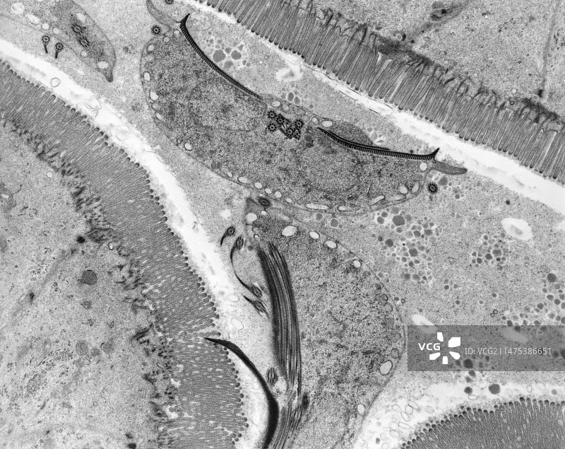 原生动物肠道感染（贾第鞭毛虫属），TEM图片素材