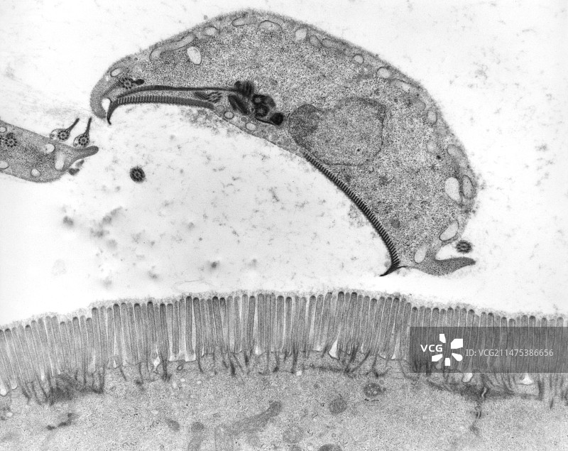 原生动物肠道感染（贾第鞭毛虫属），TEM图片素材