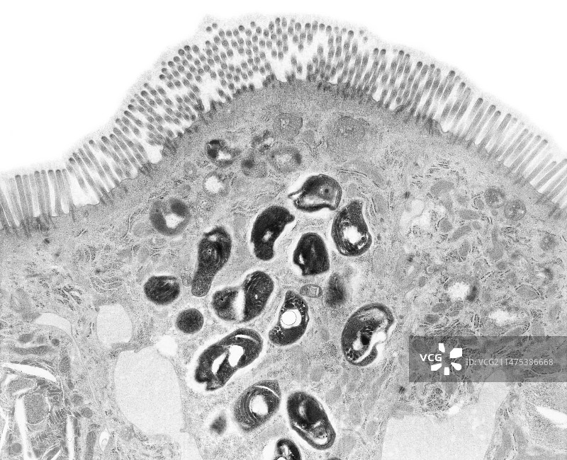 微孢子虫肠道感染（透射电镜）图片素材