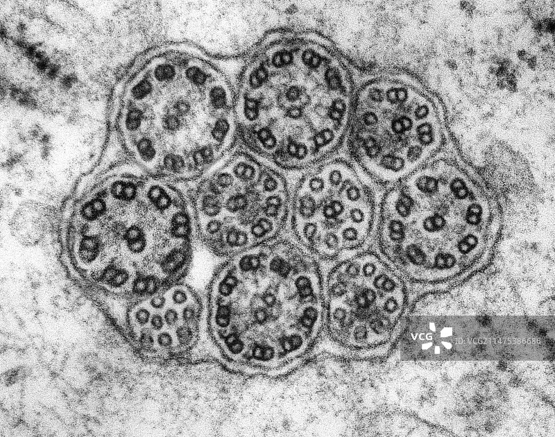 上皮纤毛微管（横截面），TEM图片素材