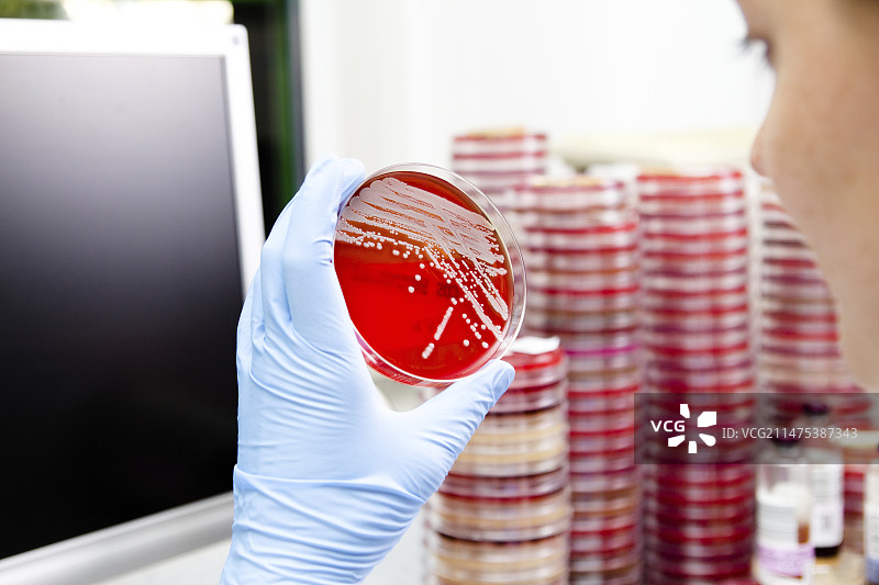 微生物学家检查琼脂培养皿图片素材