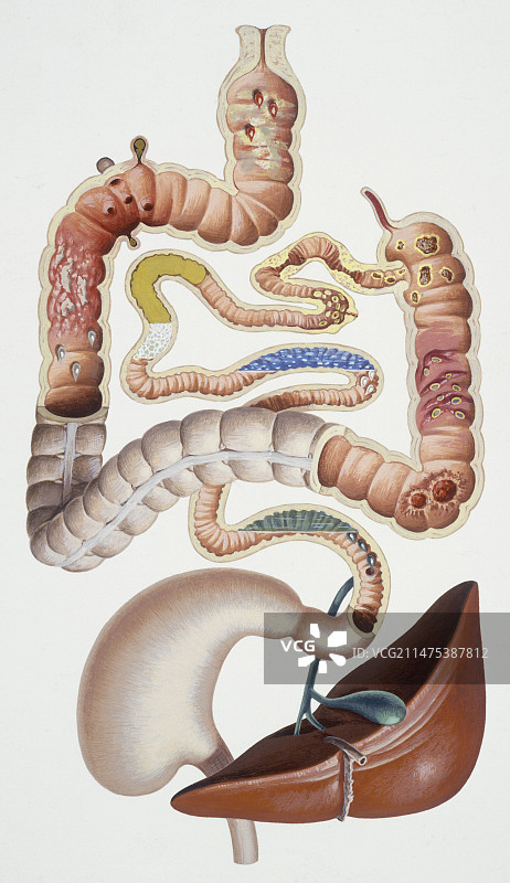 腹泻插图图片素材