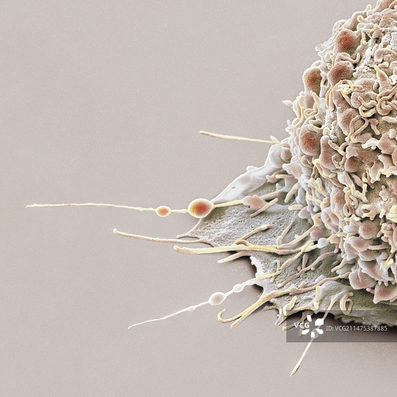 口腔癌细胞扫描电镜图图片素材