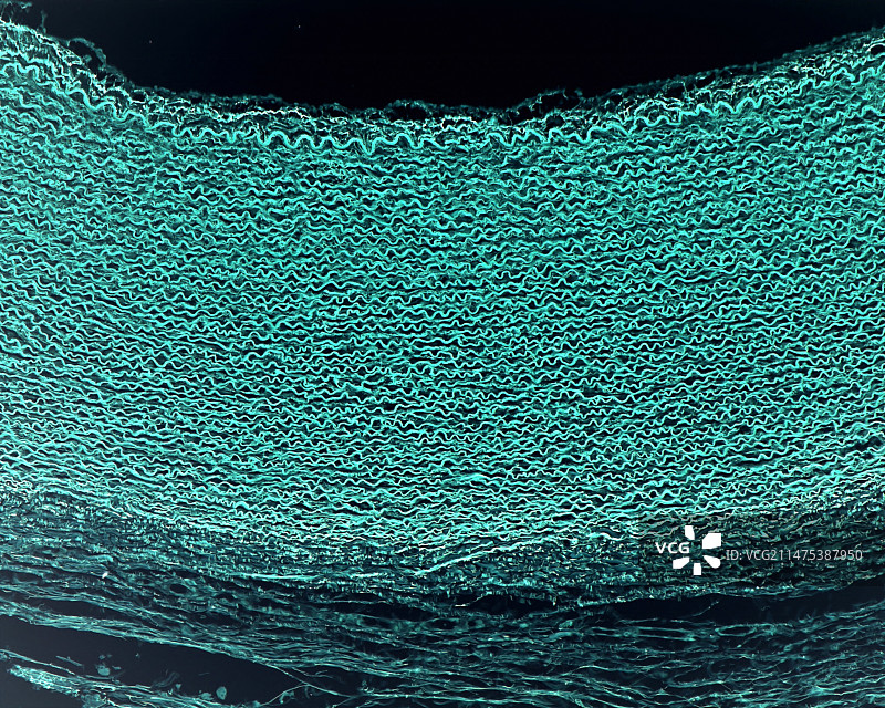 弹性动脉壁显微照片图片素材