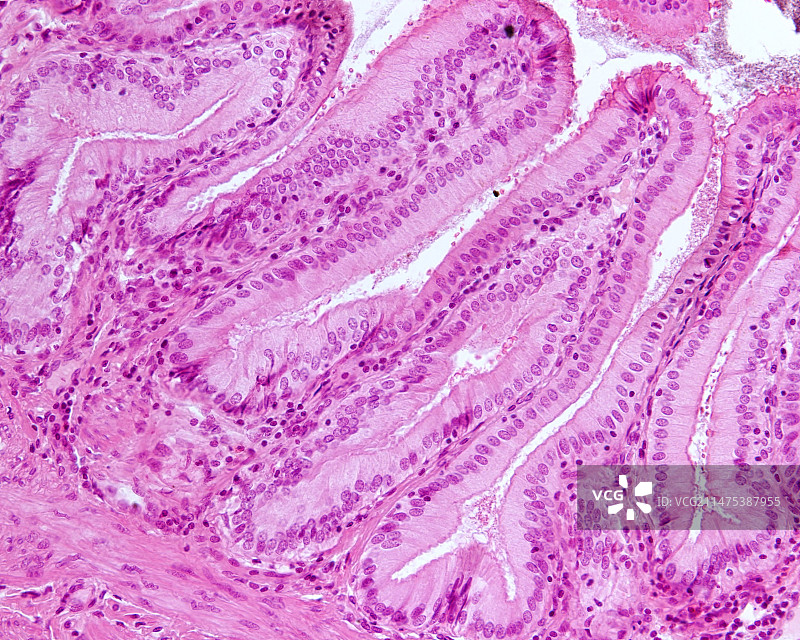 胆囊，光学显微照片图片素材