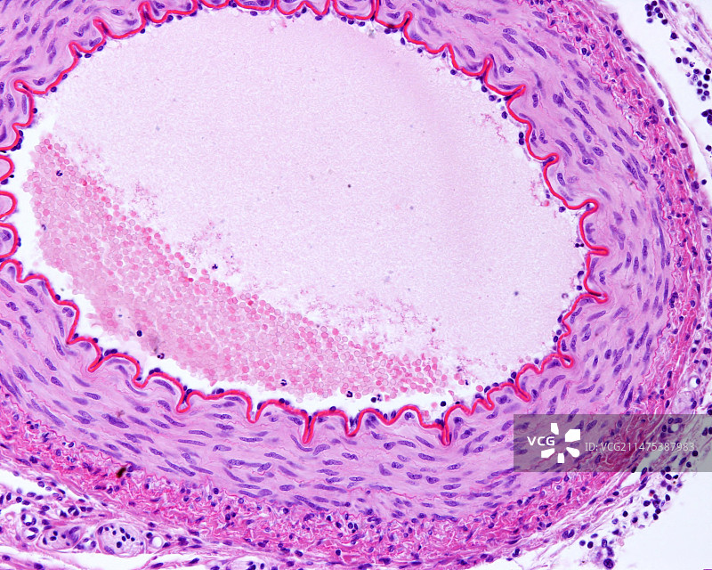 肌肉动脉显微照片图片素材