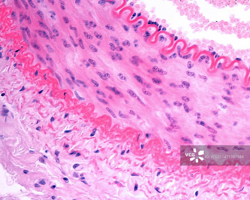 肌肉动脉显微照片图片素材