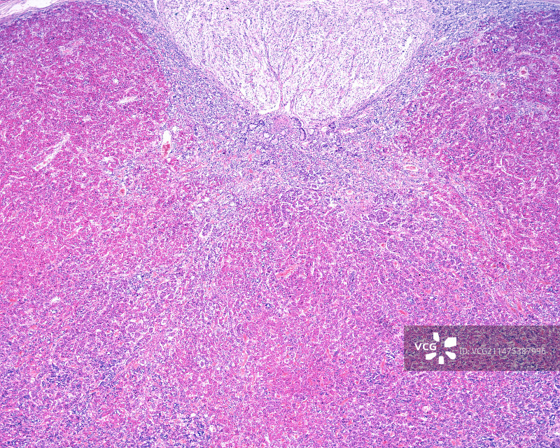 人体脑垂体显微照片图片素材