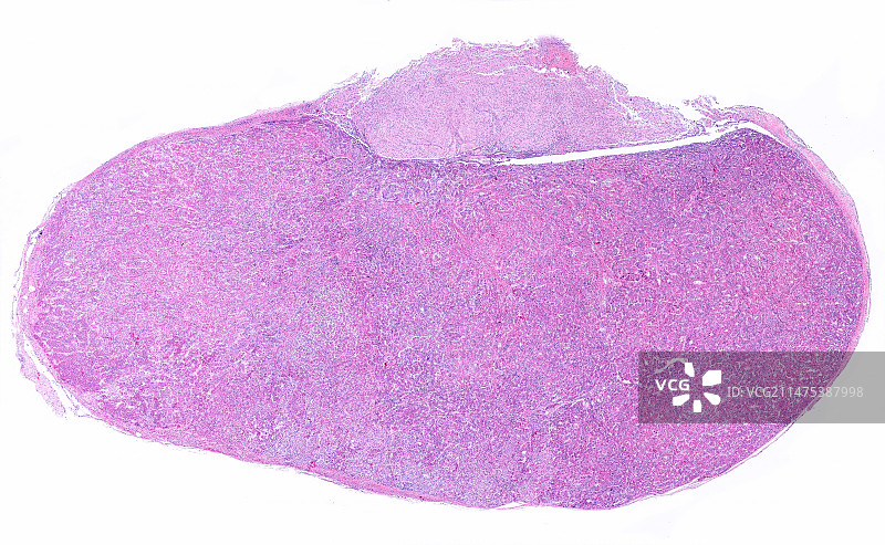 人体脑垂体显微照片图片素材