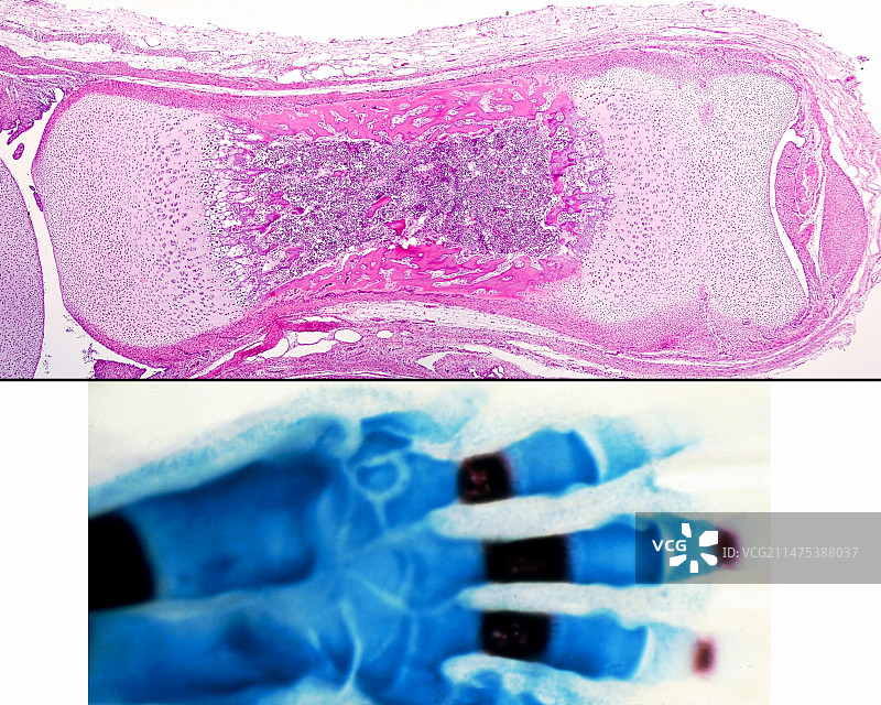 长骨骨化光显微照片图片素材