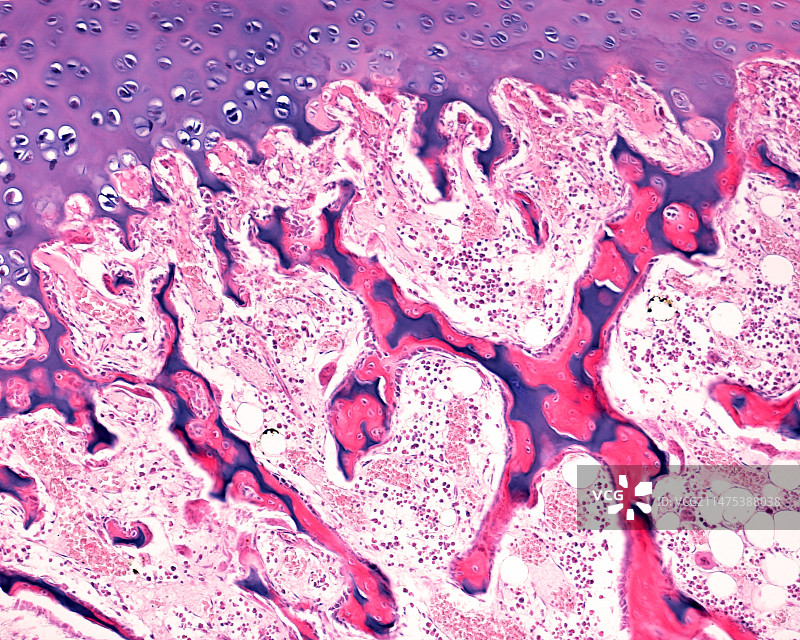 骨骼骨化显微照片图片素材
