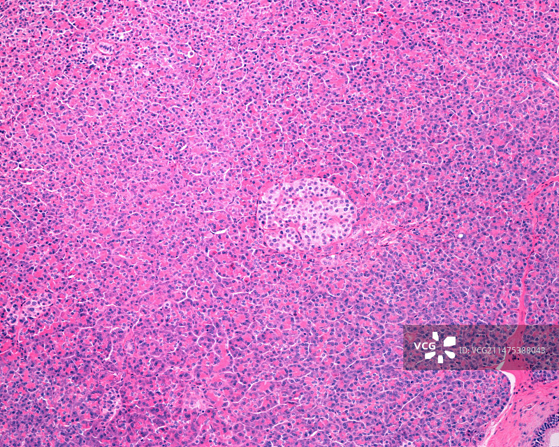 胰腺朗格汉斯岛光显微照片图片素材