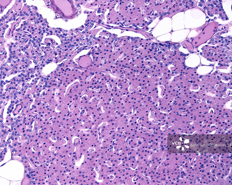 成年甲状旁腺，光学显微照片图片素材