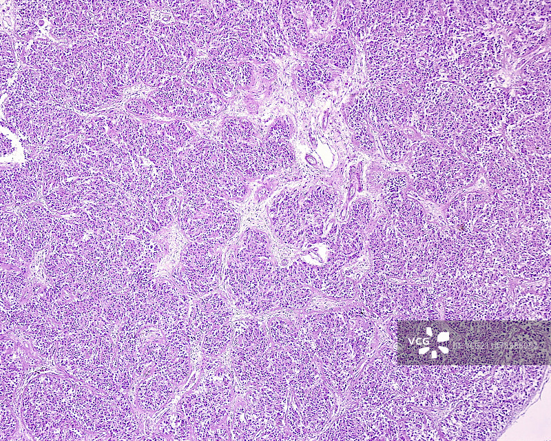 松果体小叶，光学显微照片图片素材